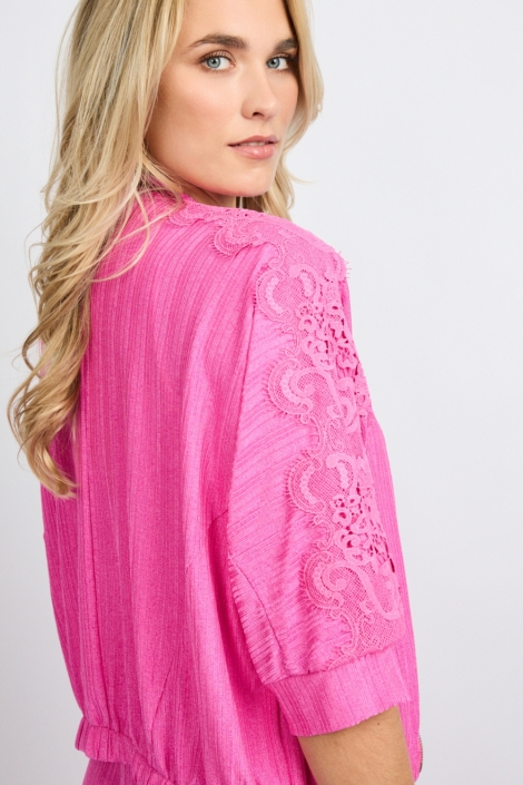 Fluresk roze dames jas | Close up